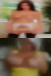 Herpes looking couple